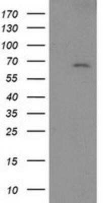 Western Blot: LNK/SH2B3 Antibody (OTI2D8)Azide and BSA Free [NBP2-72514]