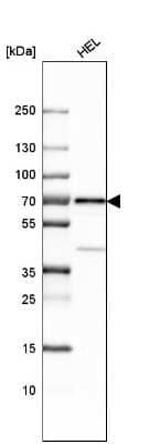 Western Blot: LNK/SH2B3 Antibody [NBP1-87867]