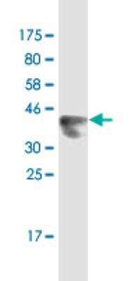 Western Blot: LNX2 Antibody (1B7) [H00222484-M02]