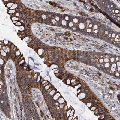 Immunohistochemistry-Paraffin: LNX2 Antibody [NBP1-81069]