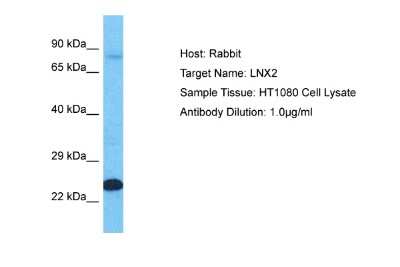 Western Blot: LNX2 Antibody [NBP2-87734]