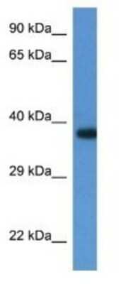 Western Blot: mediator of cell motility 1 Antibody [NBP1-74243]