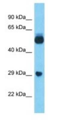 Western Blot: LOC100132249 Antibody [NBP3-09293]