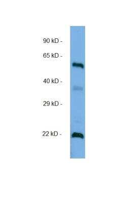 Western Blot: MLC1SA Antibody [NBP1-74247]