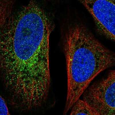 Immunocytochemistry/ Immunofluorescence: GVQW3 Antibody [NBP2-47394]