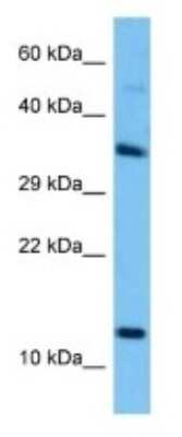 Western Blot: Svs5 Antibody [NBP3-10198]