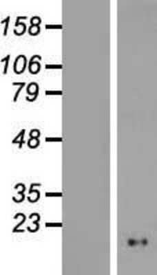 Western Blot: NOL4L-DT Overexpression Lysate [NBL1-12579]