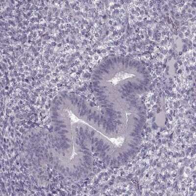 Immunohistochemistry-Paraffin: MGAT4D Antibody [NBP1-87510]