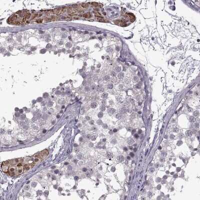 Immunohistochemistry-Paraffin: MGAT4D Antibody [NBP1-87510]