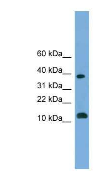 Western Blot: MGAT4D Antibody [NBP1-70604]