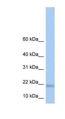 Western Blot: LOC284009 Antibody [NBP1-70605]