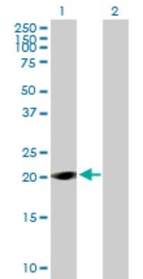 Western Blot: TAF11L1 Antibody [H00285697-B01P]
