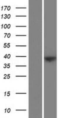 Western Blot: FAM228B Overexpression Lysate [NBP2-09757]