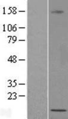 Western Blot: LOC389458 Overexpression Lysate [NBL1-12599]