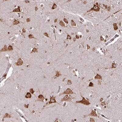 Immunohistochemistry-Paraffin: LRRC74B Antibody [NBP2-14697]