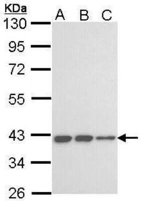 Western Blot: KIR3DL2/CD158k Antibody [NBP2-42882]