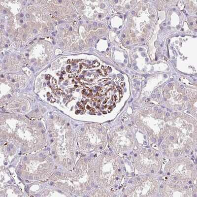 Immunohistochemistry-Paraffin: LMO7 Downstream Neighbor Antibody [NBP2-14754]