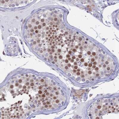 Immunohistochemistry-Paraffin: REXO5 Antibody [NBP1-92075]