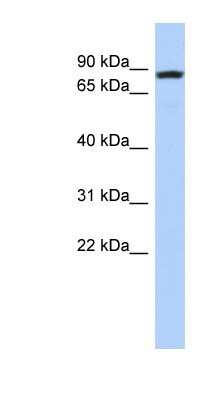 Western Blot: REXO5 Antibody [NBP1-57704]