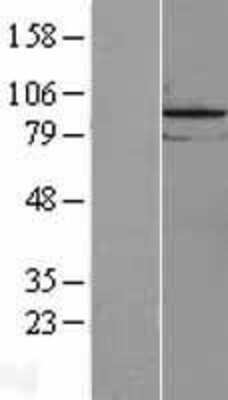 Western Blot: REXO5 Overexpression Lysate [NBL1-12631]