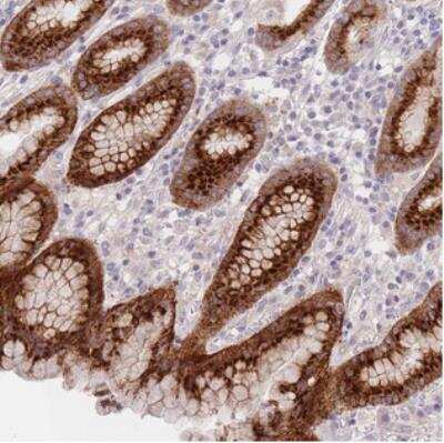 Immunohistochemistry: LOH12CR1 Antibody [NBP2-30419]