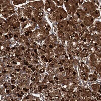 Immunohistochemistry-Paraffin: LOH12CR1 Antibody [NBP2-30597]