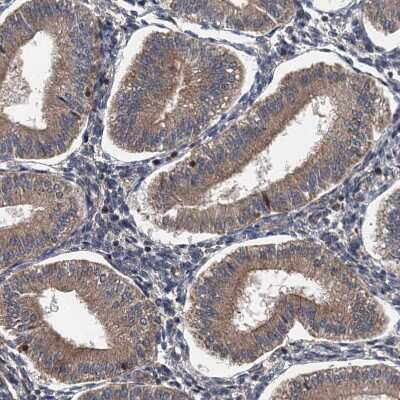 Immunohistochemistry-Paraffin: LOH12CR1 Antibody [NBP2-30597]