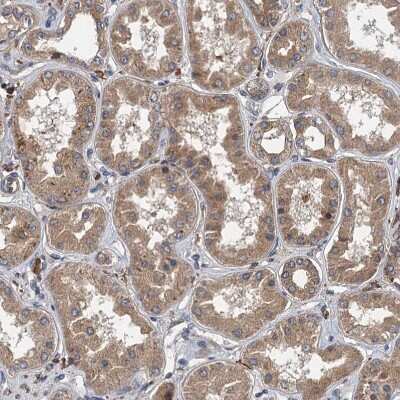 Immunohistochemistry-Paraffin: LOH12CR1 Antibody [NBP2-30597]