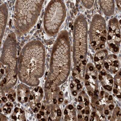 Immunohistochemistry-Paraffin: LOH12CR1 Antibody [NBP2-30597]