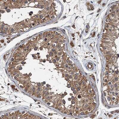 Immunohistochemistry-Paraffin: LOH12CR1 Antibody [NBP2-30597]