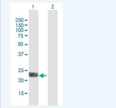 Western Blot: LOH12CR1 Antibody [H00118426-B01P-50ug]