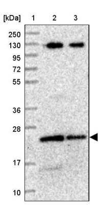 Western Blot: LOH12CR1 Antibody [NBP2-30597]