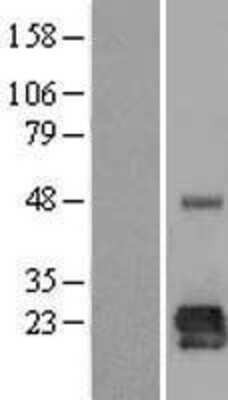 Western Blot: LOH12CR1 Overexpression Lysate [NBL1-12637]