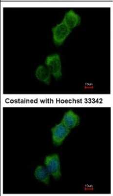 Immunocytochemistry/ Immunofluorescence: LOK Antibody [NBP2-19368]