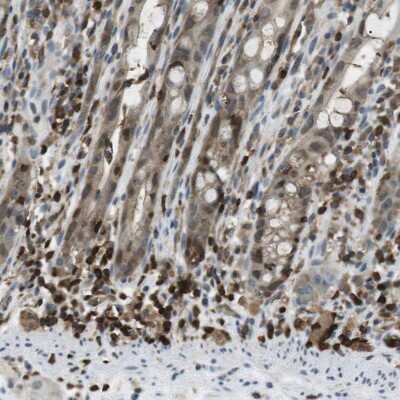 Immunohistochemistry-Paraffin: LOK Antibody [NBP2-13396]