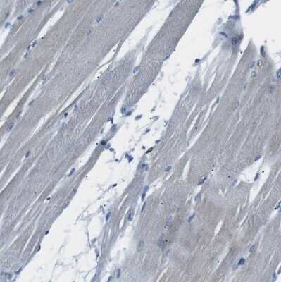 Immunohistochemistry-Paraffin: LOK Antibody [NBP2-13396]