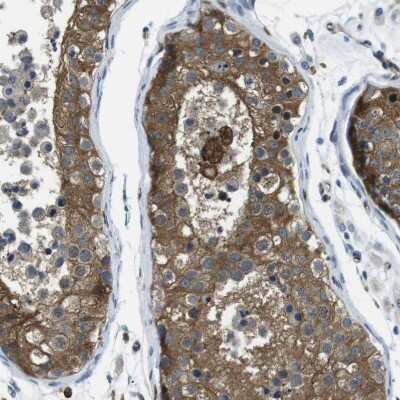 Immunohistochemistry-Paraffin: LOK Antibody [NBP2-13396]