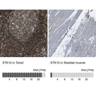 Immunohistochemistry-Paraffin: LOK Antibody [NBP2-13396]