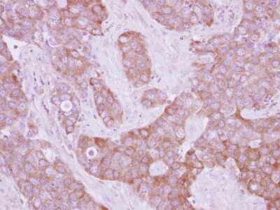 Immunohistochemistry-Paraffin: LOK Antibody [NBP2-19368]