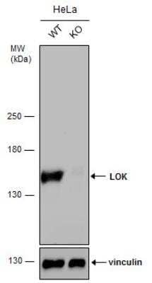 Knockout Validated: LOK Antibody [NBP2-19367]