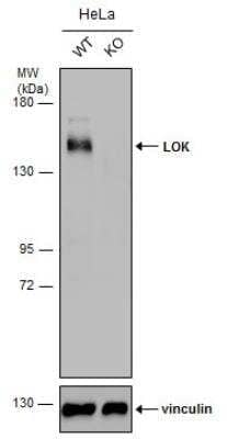 Knockout Validated: LOK Antibody [NBP2-19368]