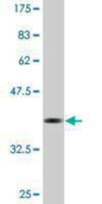 Western Blot: LONP1 Antibody (3B2) [H00009361-M01]