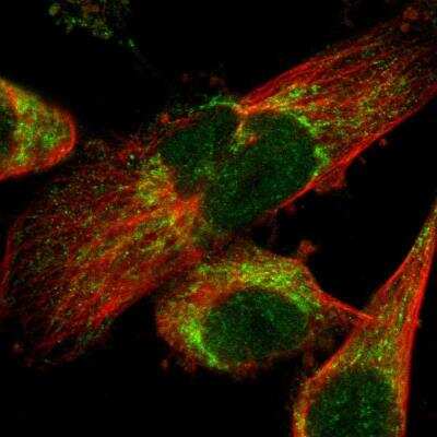 Immunocytochemistry/ Immunofluorescence: LONP1 Antibody [NBP2-76504]