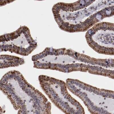 Immunohistochemistry-Paraffin: LONP1 Antibody [NBP1-81734]