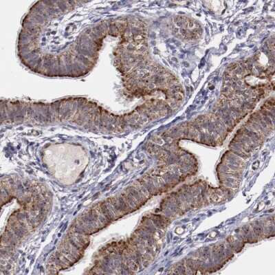 Immunohistochemistry-Paraffin: LONP1 Antibody [NBP1-81734]