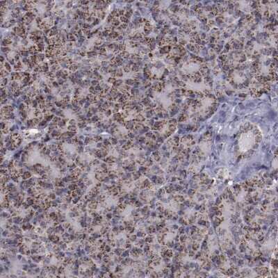 Immunohistochemistry-Paraffin: LONP1 Antibody [NBP1-81734]