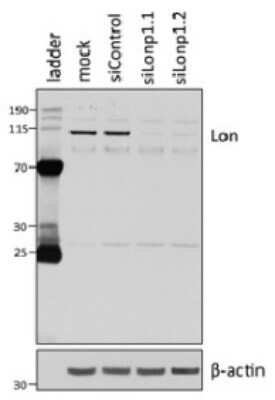 Western Blot: LONP1 Antibody (LON20/H1)BSA Free [NBP2-50478]