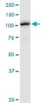 Western Blot: LONP1 Antibody [H00009361-D01P]