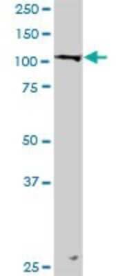 Western Blot: LONP1 Antibody [H00009361-D01P]