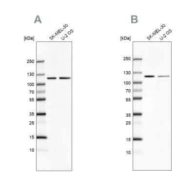 Western Blot: LONP1 Antibody [NBP2-76504]